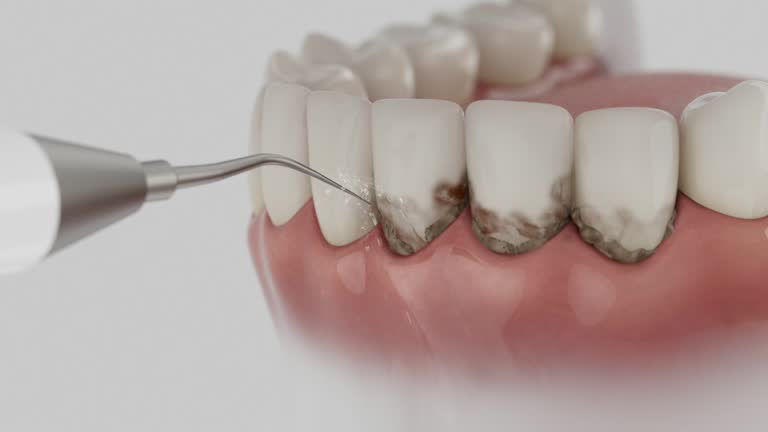 Trusted Teeth Cleaning And Checkup service in North Lakeport, CA - Dentist Open Now